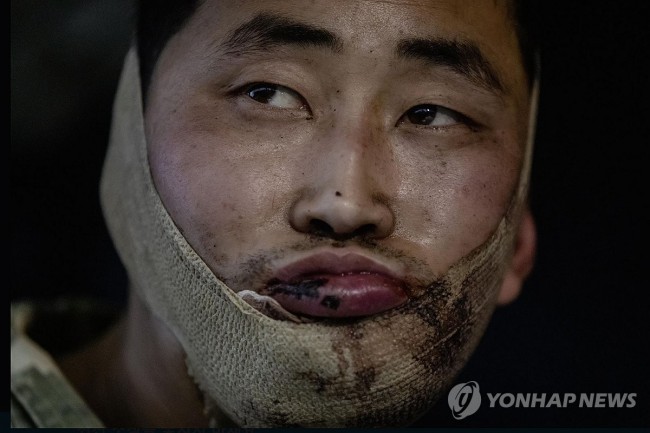 우크라이나군이 생포한 북한군 포로